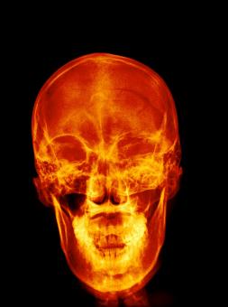 Free Stock Photo of Lateral Radiograph X-ray of the Skull