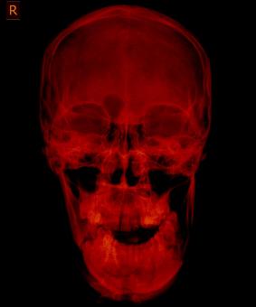 Free Stock Photo of Red Xray of a Skull