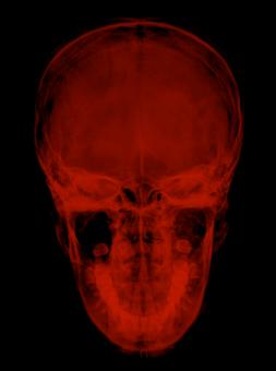 Free Stock Photo of Xray of the back of a skull