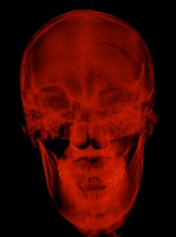 Free Stock Photo of Red radiograph xray of a skull