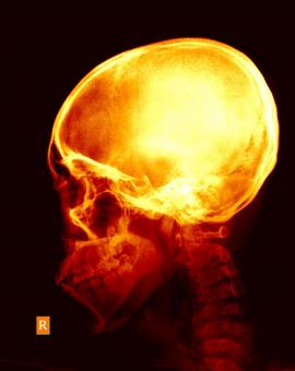 Free Stock Photo of Skull Xray