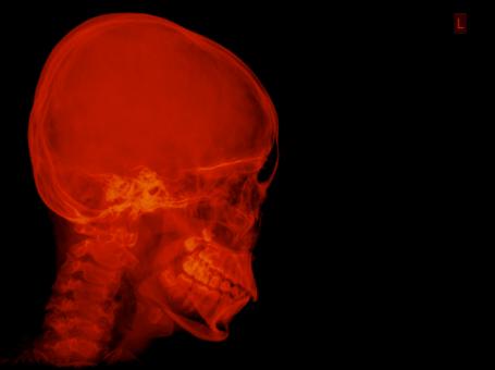 Free Stock Photo of Red skull X-ray