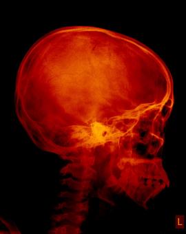 Free Stock Photo of Non Angled Radiograph Human Skull