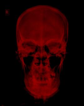 Free Stock Photo of Red Radiograph Xray of Skull