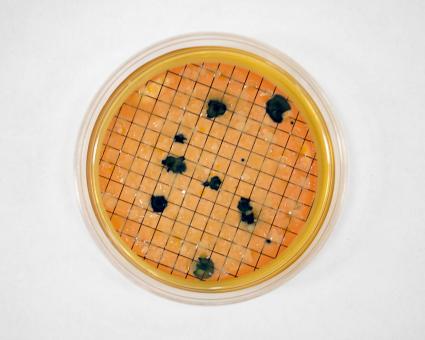 Free Stock Photo of Coliforms