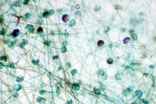 Free Stock Photo of Mold Sporangium