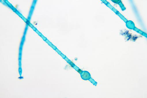 Free Stock Photo of Oedogonium