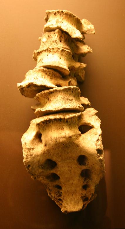 Free stock image of Spinal column created by Bjorgvin