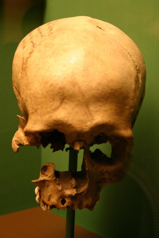 Free stock image of Skull created by Bjorgvin