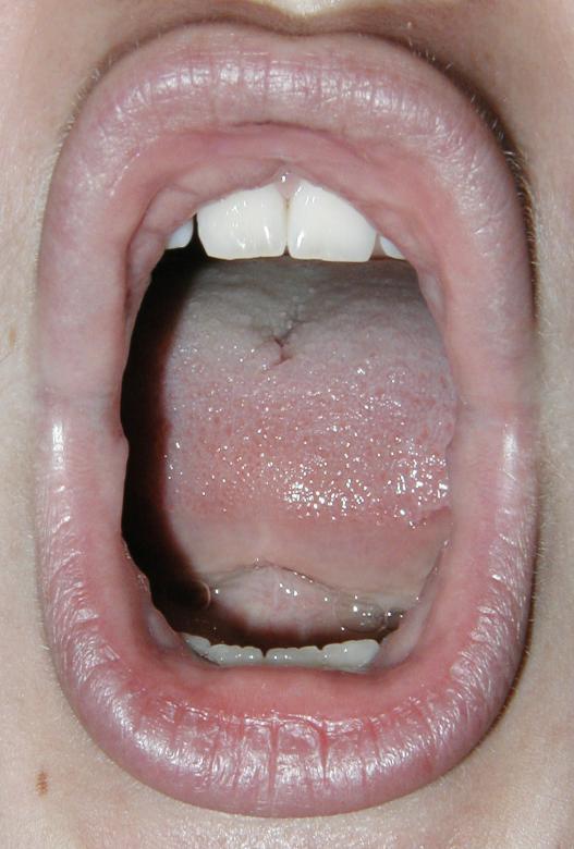 Free stock image of Open mouth created by Bjorgvin