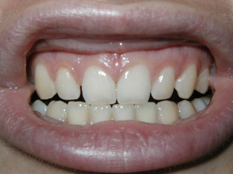 Free stock image of Teeth created by Bjorgvin