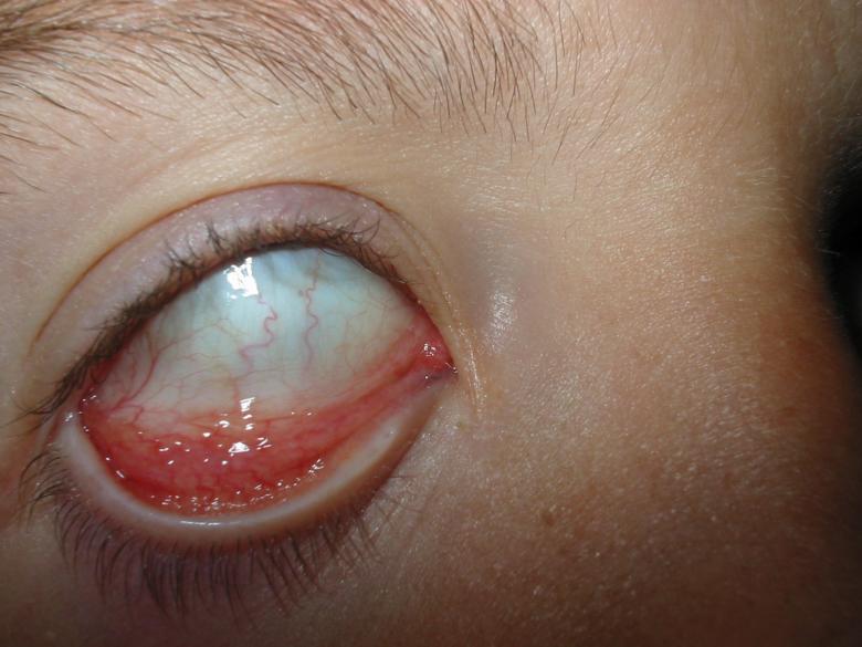 Free stock image of Eye created by prime