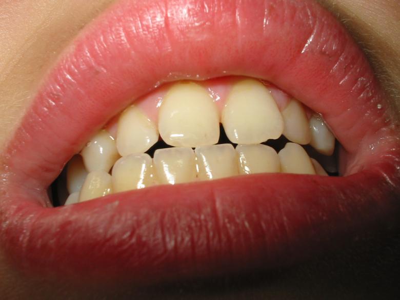 Free stock image of Mouth created by prime