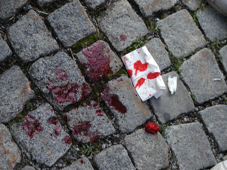 Free stock image of Blood on the pavement created by sn4tch
