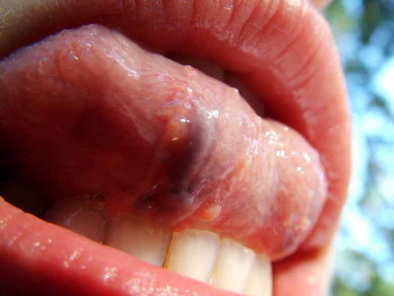 Free stock image of Toungue created by ole kristen johansen