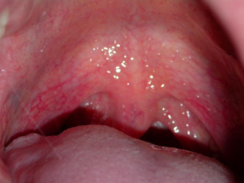 Free stock image of Mouth created by raymond henry