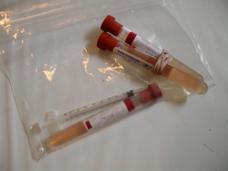 Free stock image of Needles created by raymond henry