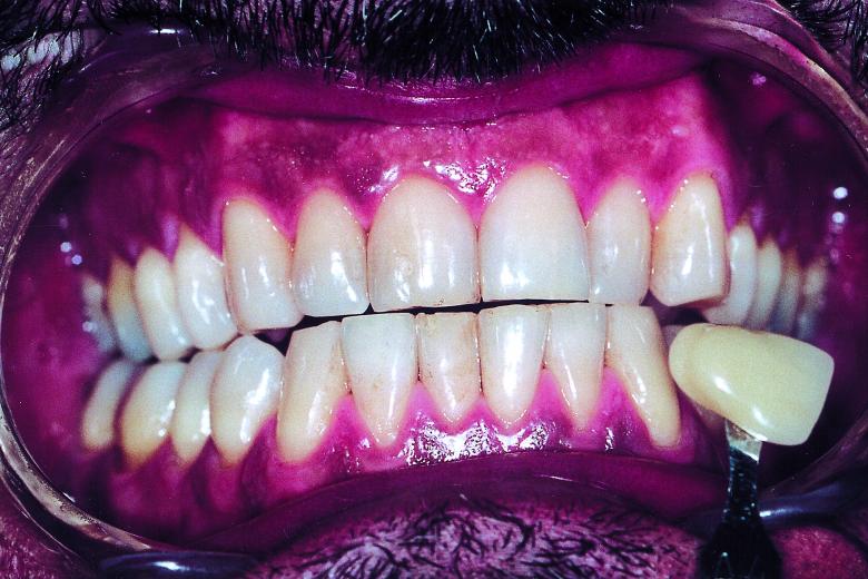 Free stock image of Teeth created by Bjorgvin