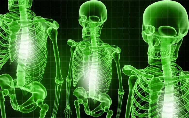 Free stock image of Skeletal X-Ray - Green Background created by dileepdivakaran