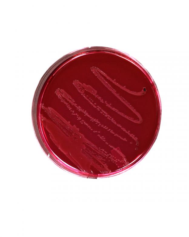 Free stock image of Salmonella bacteria created by Geoffrey Whiteway
