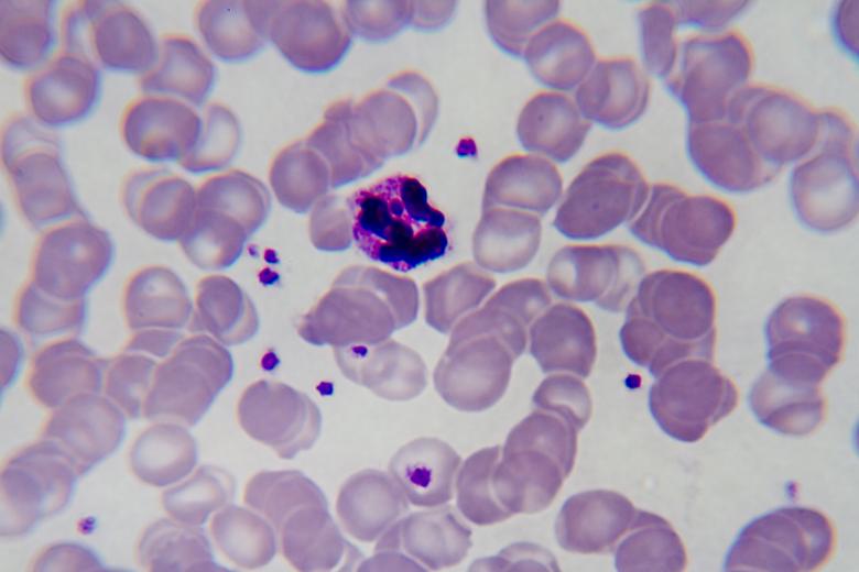 Free stock image of Malaria created by Geoffrey Whiteway