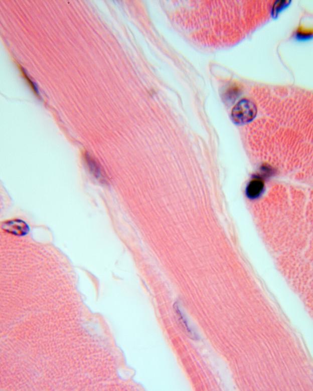 Free stock image of Muscle tissue created by Geoffrey Whiteway