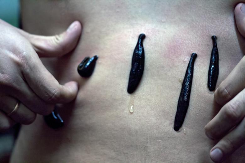 Free stock image of Leeches created by 2happy
