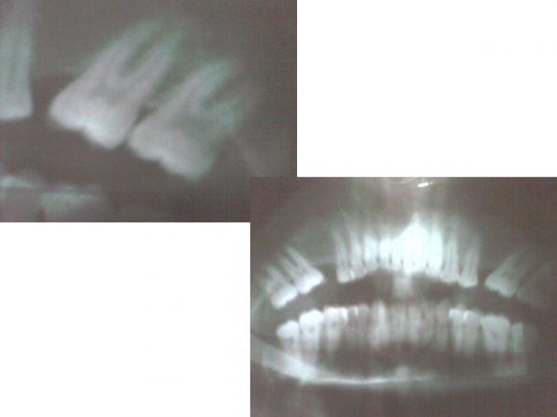 Free stock image of Dental ultrasound created by chakomajaw