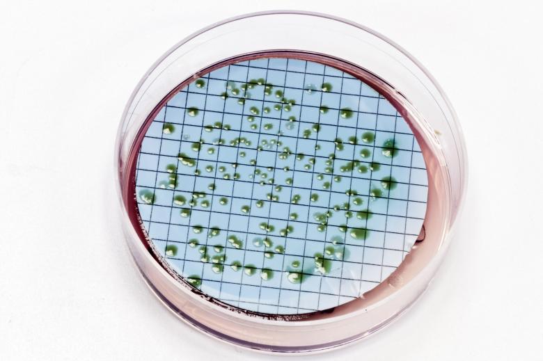 Free stock image of Pseudomonas bacteria on agar plate created by Geoffrey Whiteway