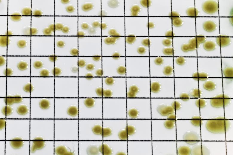 Free stock image of Macro of Pseudomonas bactera colonies created by Geoffrey Whiteway