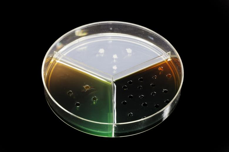 Free stock image of Food Safety Antigen Antibody Test created by Geoffrey Whiteway