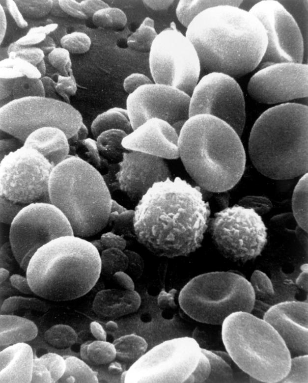 Free stock image of Blood Cells created by Pixabay