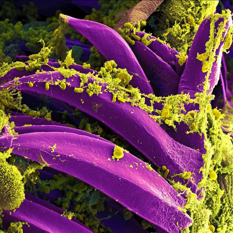 Free stock image of Bacteria  created by Pixabay