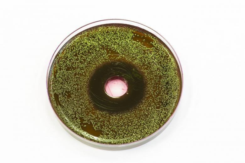 Free stock image of Bacteria growing on EMB agar created by Geoffrey Whiteway