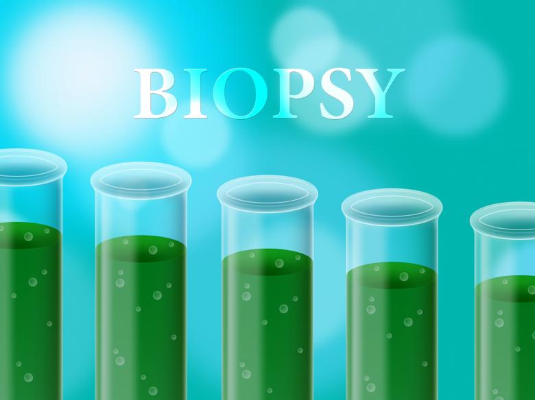 Free stock image of Biopsy Test Means Researched Laboratory And Analyse created by Stuart Miles