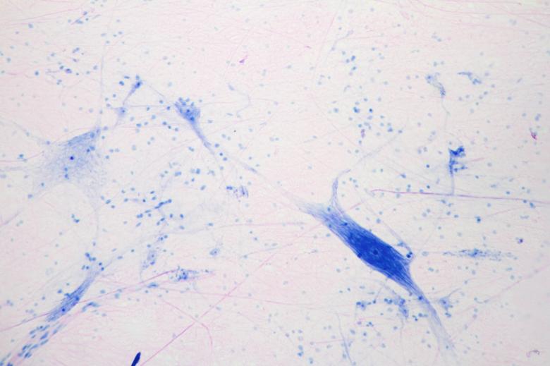 Free stock image of Multipolar Neuron Texture created by Geoffrey Whiteway