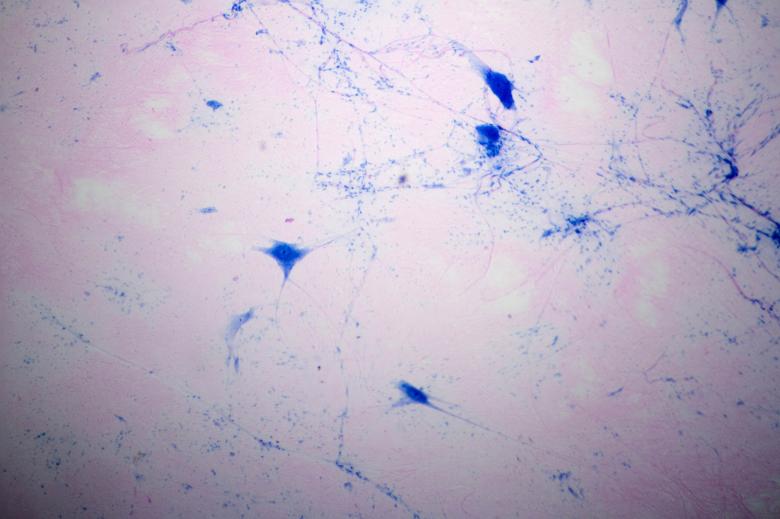 Free stock image of Multipolar Neuron Microscope View created by Geoffrey Whiteway