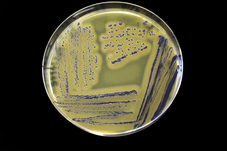 Free stock image of Staphylococcus Aureus created by Geoffrey Whiteway