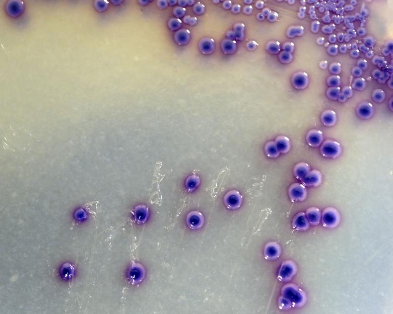 Free stock image of Bacteria Close Up created by Geoffrey Whiteway