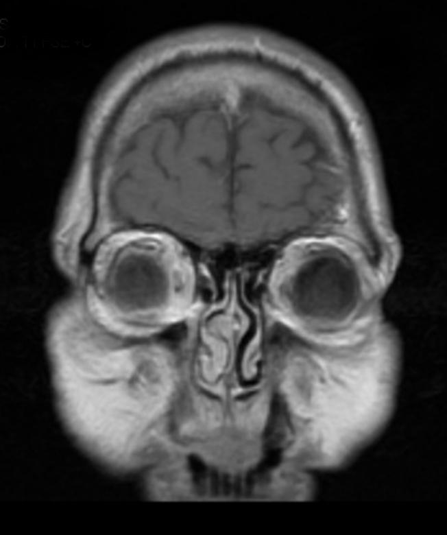 Free stock image of MRI Head Scan created by rudy liggett
