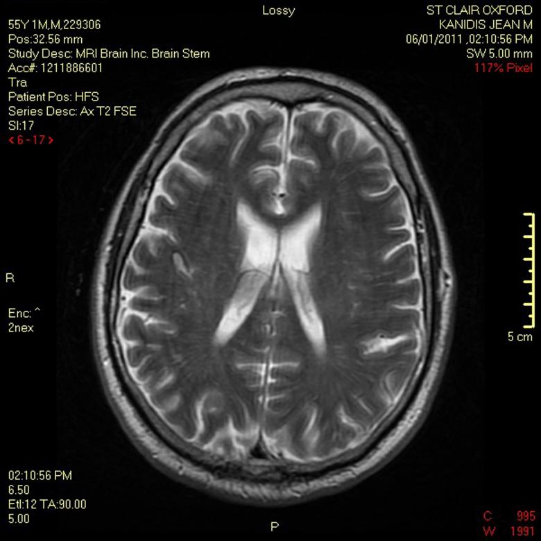 Free stock image of MRI of my Brain created by rudy liggett