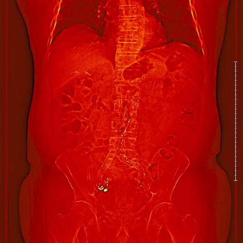 Free stock image of CT with hot metal effect created by rudy liggett