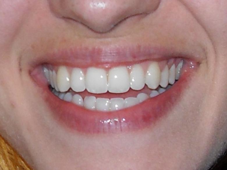 Free stock image of Beautiful Smile Close Up created by Chris