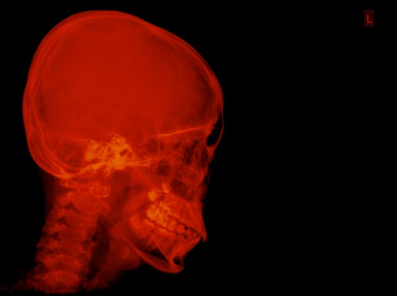Free stock image of Red skull X-ray created by Sugiyatno