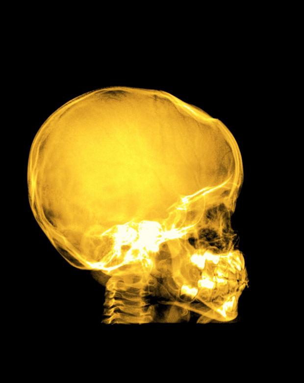 Free stock image of Yellow Skull Xray on Black created by Sugiyatno
