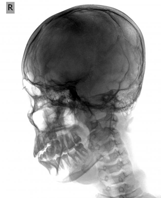 Free stock image of Radiograph of the Skull created by Sugiyatno