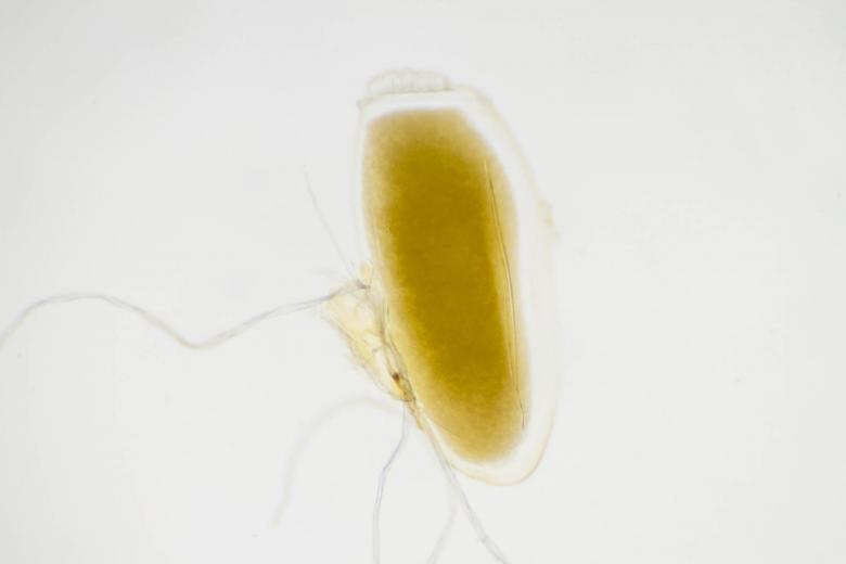 Free stock image of Pediculus humanus corporis egg created by Geoffrey Whiteway