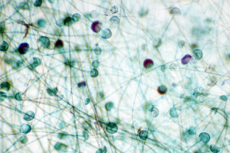 Free stock image of Mold Sporangium created by Geoffrey Whiteway