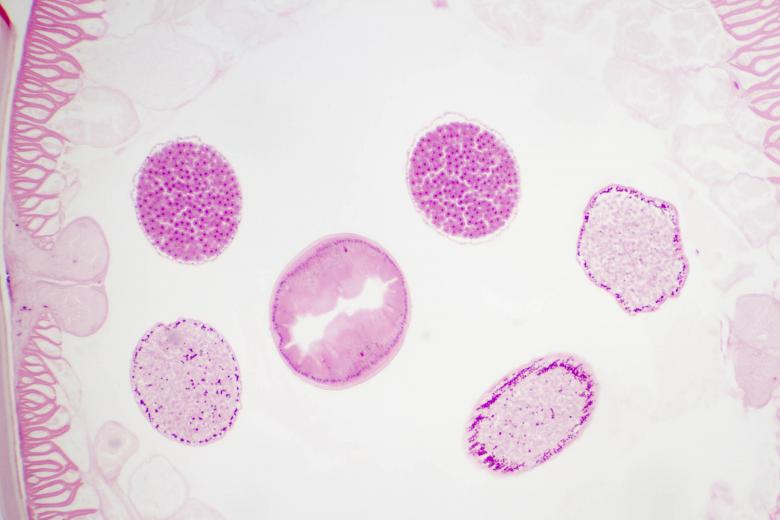 Free stock image of Ascaris Lumbricoides created by Geoffrey Whiteway