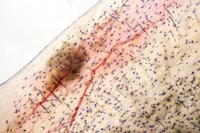 Free stock image of Fish scale in microscope created by Geoffrey Whiteway